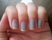 Imagen ilustrativa del artículo Uñas negras: 6 principales causas y qué hacer