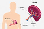 Illustrative image of the article Splenectomy: Indications, Procedure & Recovery