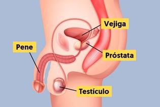 Imagen ilustrativa del artículo Cáncer de próstata: síntomas, causas y tratamiento (con test online)