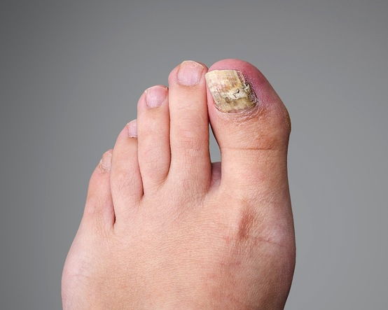 Imagem ilustrativa número 3