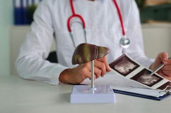 Imagen ilustrativa del artículo ¿Dónde está el hígado?