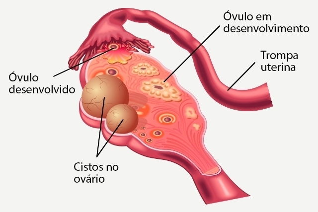 Imagem ilustrativa número 2