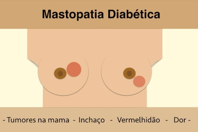 Imagem ilustrativa número 1