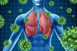 Imagem ilustrativa do artigo Tratamento para infecção pulmonar (e possíveis complicações)