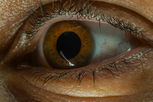 Illustrative image of the article Blue Sclera: What It Looks Like & 8 Possible Causes