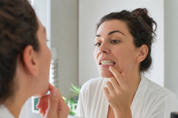 Woman checking receding gums | AI-generated image