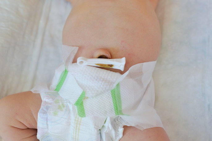 newborn baby with diaper and umbilical cord stump