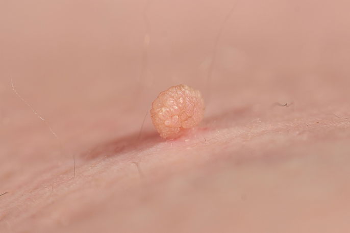 Imagem ilustrativa número 2