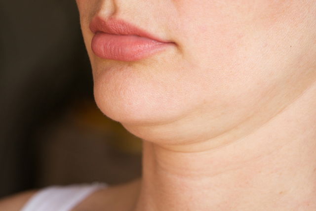 Illustrative image of the article How to Get Rid of a Double Chin (Natural Solutions, Surgery & More)