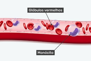 Imagem ilustrativa do artigo Monócitos: o que são, valor de referência e porque estão altos ou baixos