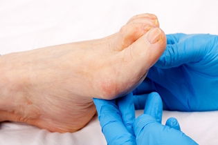 Illustrative image of the article Swollen Feet & Ankles: 14 Common Causes & What to Do