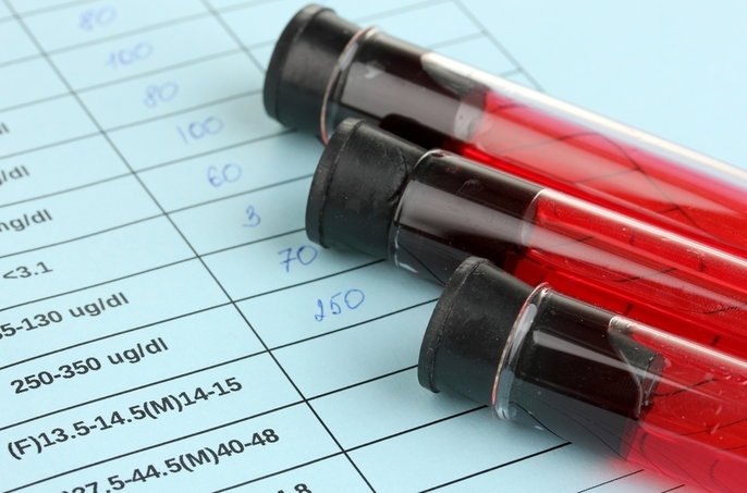 tubes of blood