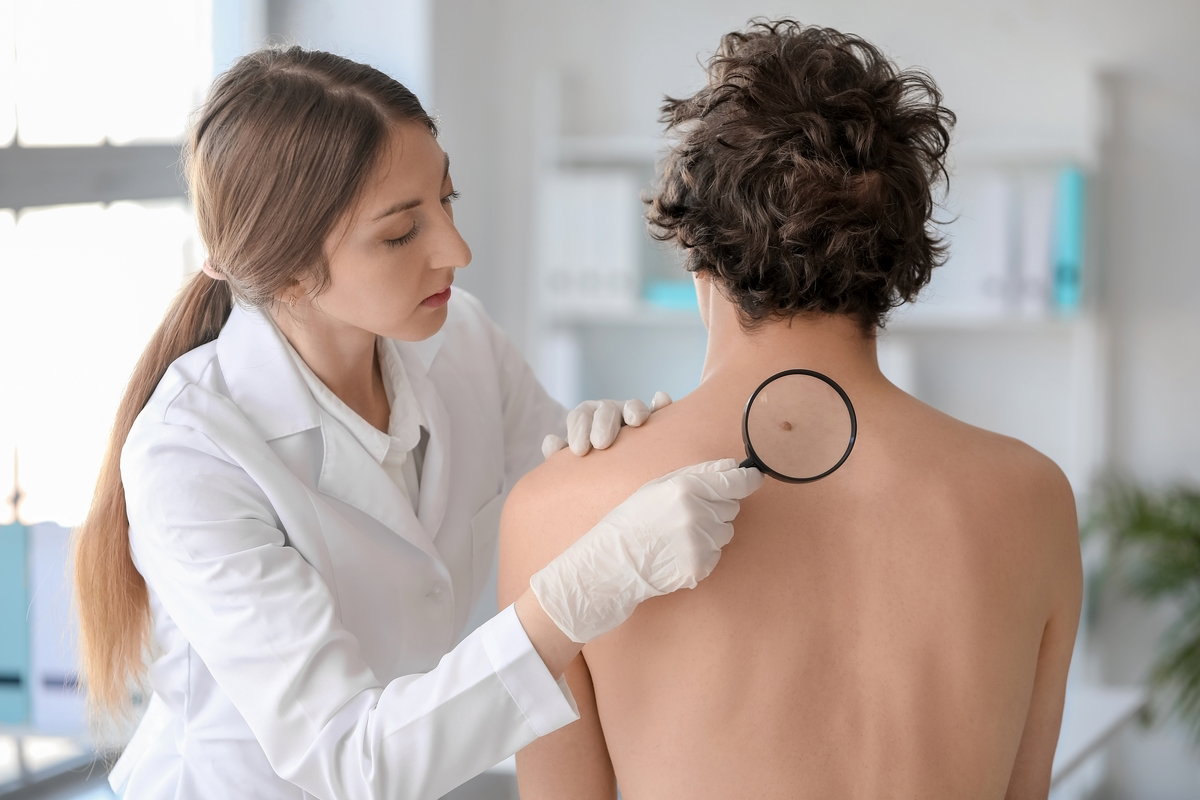 5 Sinais e Sintomas de Câncer de Pele (melanoma e Não-melanoma)