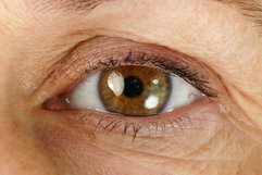 Imagen ilustrativa del artículo Gusano del ojo: síntomas, transmisión y tratamiento