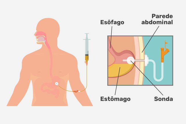 Imagem ilustrativa número 2