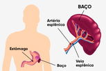 Imagem ilustrativa do artigo Esplenectomia: o que é, quando fazer, riscos e recuperação