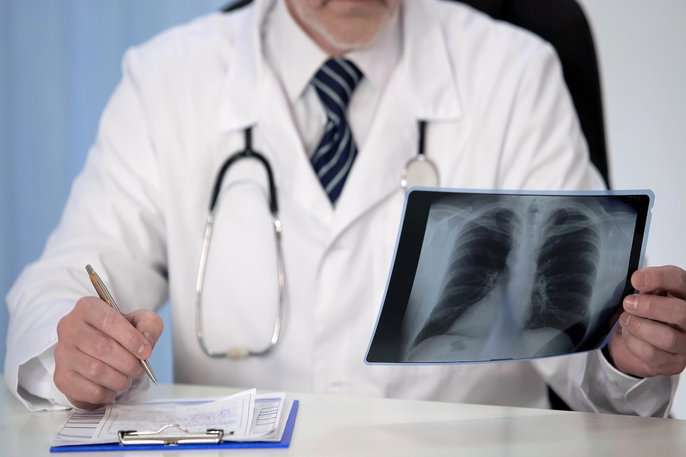 Médico analisando rx por neumonía
