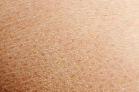 Illustrative image of the article Skin Peeling: 9 Reasons Your Skin Is Peeling (with Pictures)