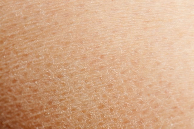 Illustrative image of the article Skin Peeling: 9 Reasons Your Skin Is Peeling (with Pictures)