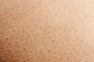 Illustrative image of the article Skin Peeling: 9 Reasons Your Skin Is Peeling (with Pictures)