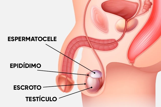 Imagem ilustrativa número 1