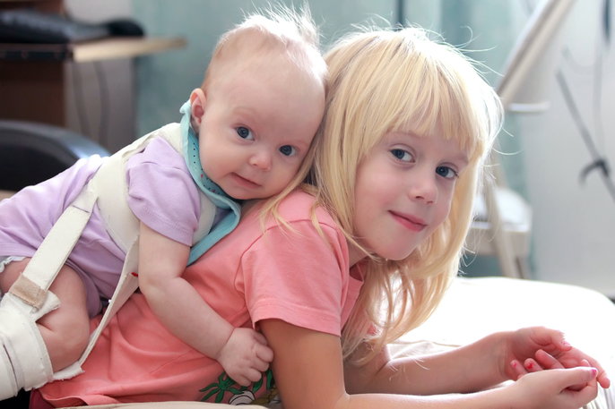 baby in a Pavlik harness hugging big sister