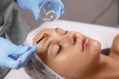 Imagem ilustrativa do artigo Peeling retinoico: o que é, para que serve, como é feito (e cuidados)