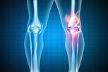 Illustrative image of the article Why Do My Knees Crack? (8 Possible Causes & What to Do)