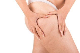 Illustrative image of the article How to Get Rid of Swelling from Water Retention