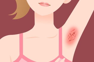 Illustrative image of the article Armpit Pain: 9 Common Causes (& How to Treat