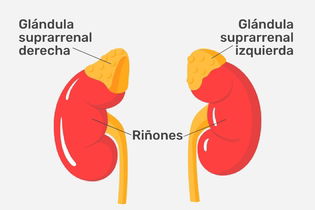 Imagen ilustrativa del artículo Enfermedad de Addison: qué es, síntomas y tratamiento