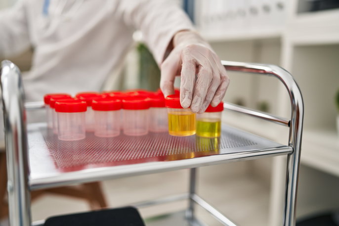 Ilustração de cristais na urina vistos em um microscópio