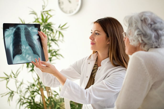 médecin montrant une radiographie à un patient où l'on aperçoit un emphysème pulmonaire