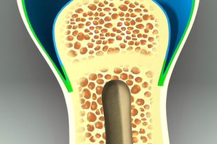 Imagem ilustrativa do artigo Biomatrop: remédio para nanismo