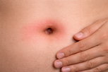 Illustrative image of the article Red Belly Button: 7 Possible Causes (& What to Do)