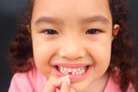 Imagen ilustrativa del artículo ¿A qué edad se caen los dientes de leche?