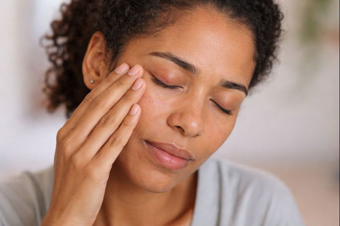 Woman with periocular dermatitis | AI-generated image