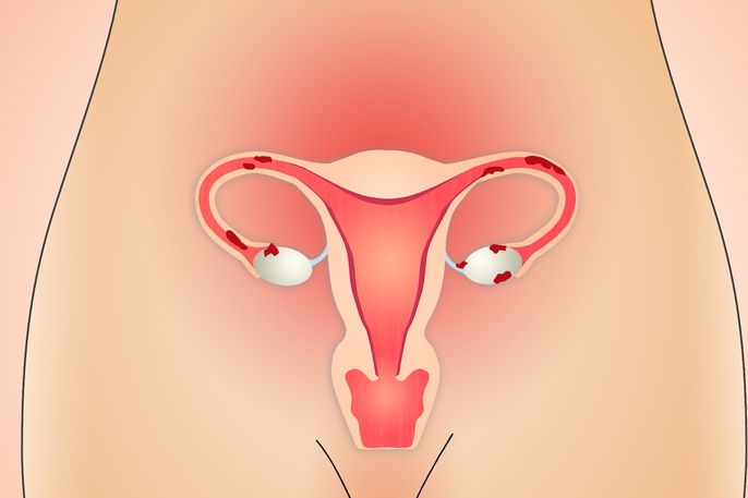 Imagem ilustrativa número 2