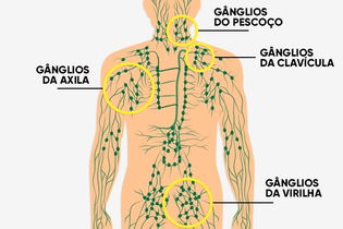 Imagem ilustrativa do artigo Gânglios linfáticos: o que são, função e onde ficam