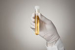 Illustrative image of the article 24 Hour Urine Test: Uses, How to Perform & Normal Levels