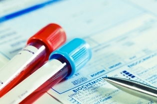 Illustrative image of the article CA 125 Blood Test: What Is It, Uses & Normal Levels 