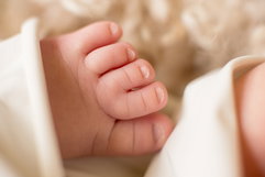 Illustrative image of the article Syndactyly: Causes, Types & Treatment
