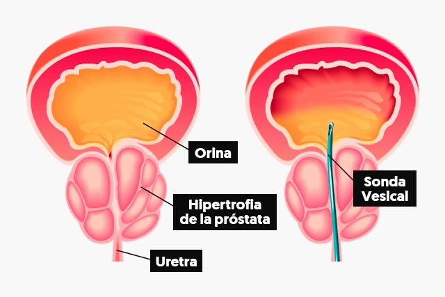 Imagem ilustrativa número 1