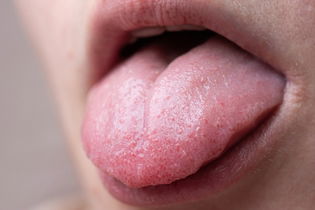 Illustrative image of the article Bumps on Tongue: 10 Common Causes (& What to Do)