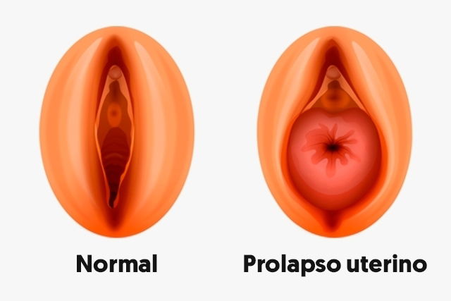 Imagem ilustrativa número 1