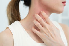 Imagem ilustrativa do artigo Alergia a medicamentos: sintomas e o que fazer (é possível evitar?)