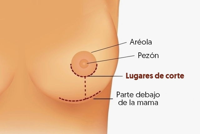 Imagem ilustrativa número 2