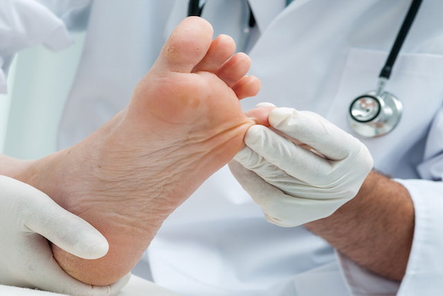Doctor assessing toes