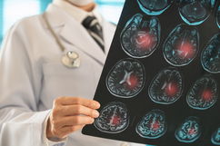 Imagem ilustrativa do artigo Especialistas em aneurisma cerebral: qual médico consultar?