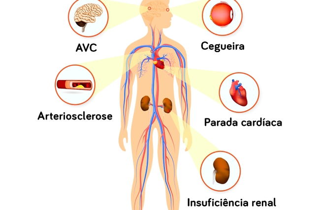 Imagem ilustrativa número 1